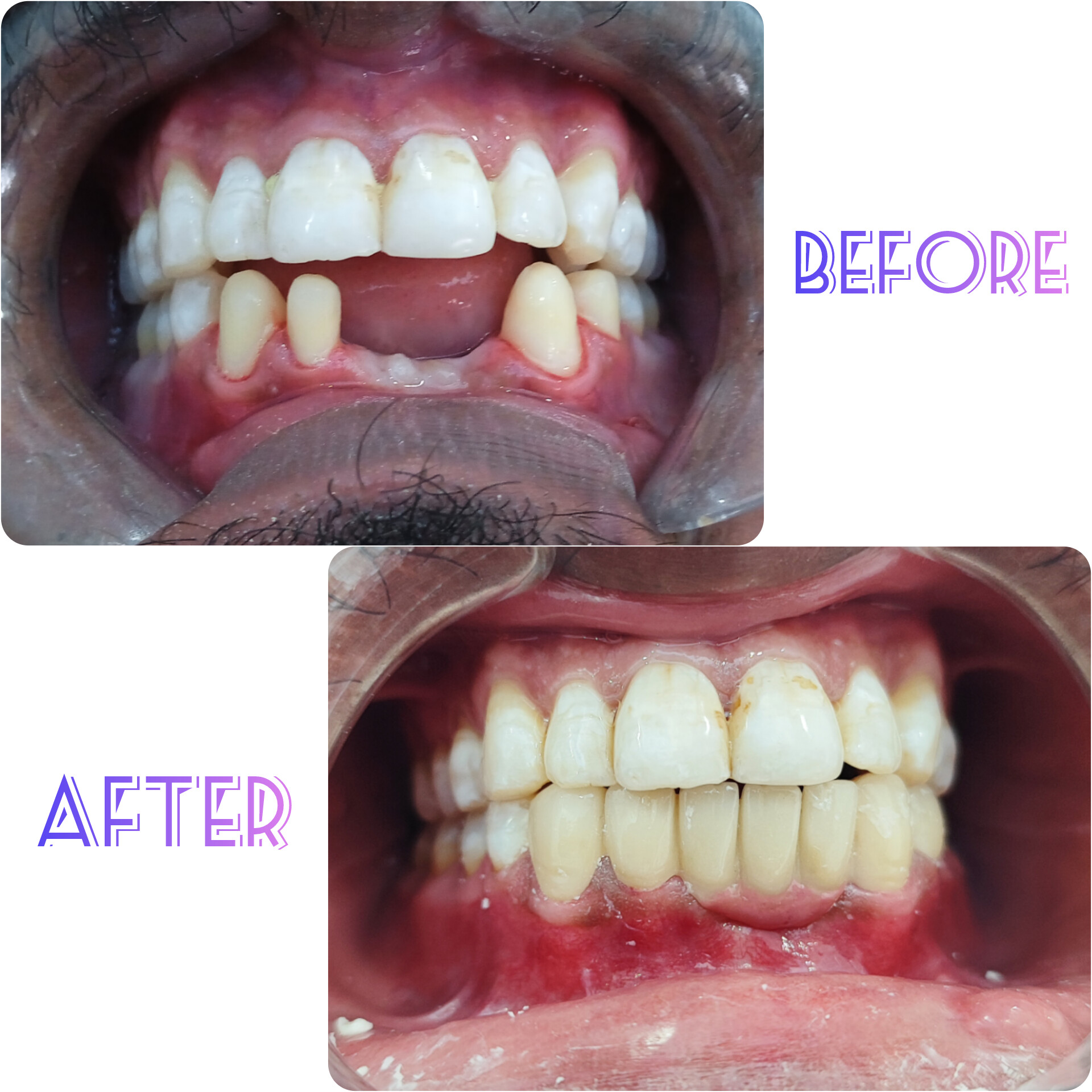 best dental hospial hosur