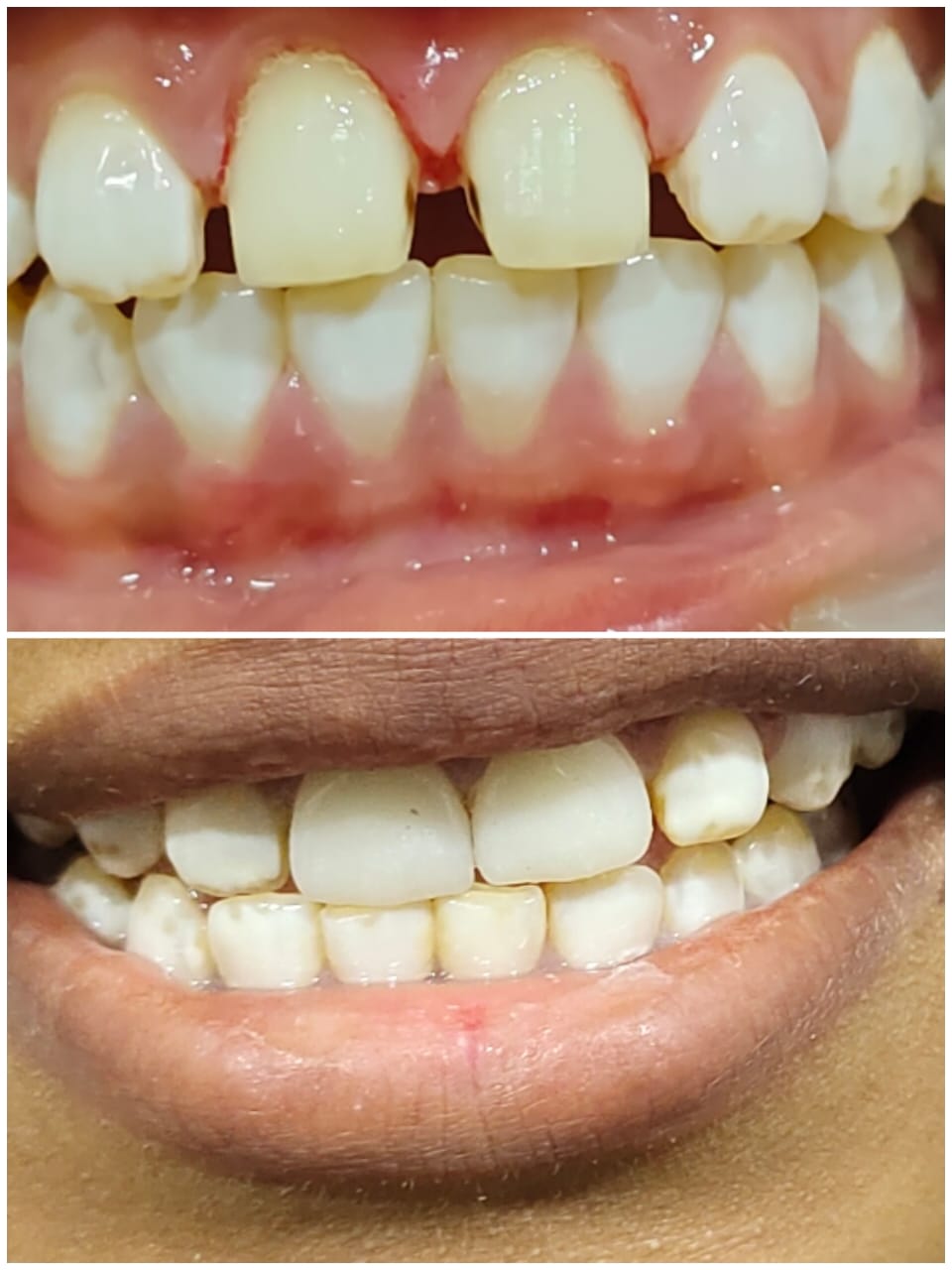 best dental hospial hosur