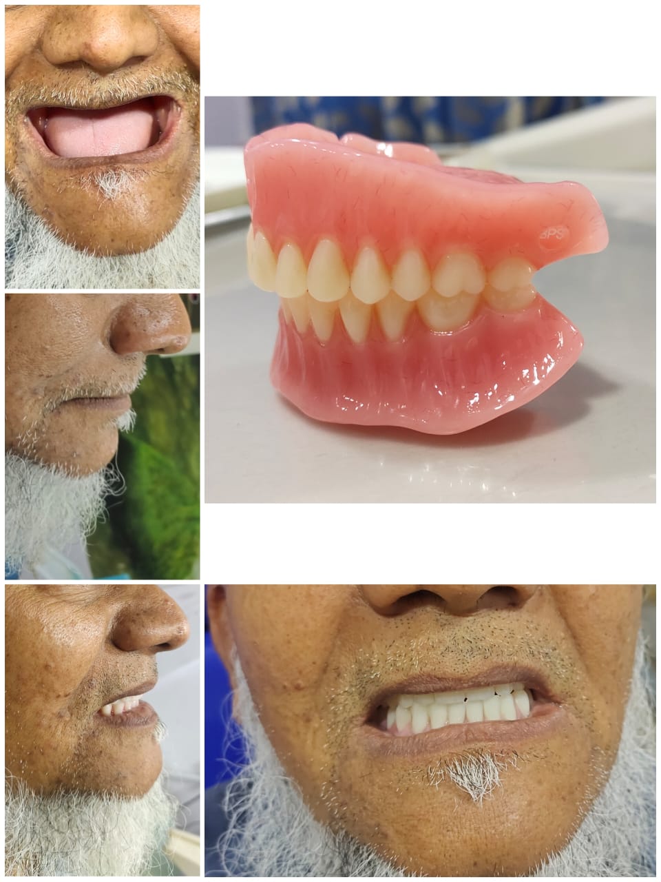 best dental hospial hosur