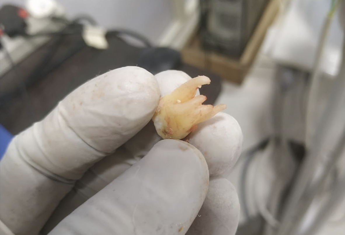 best dental hospial hosur