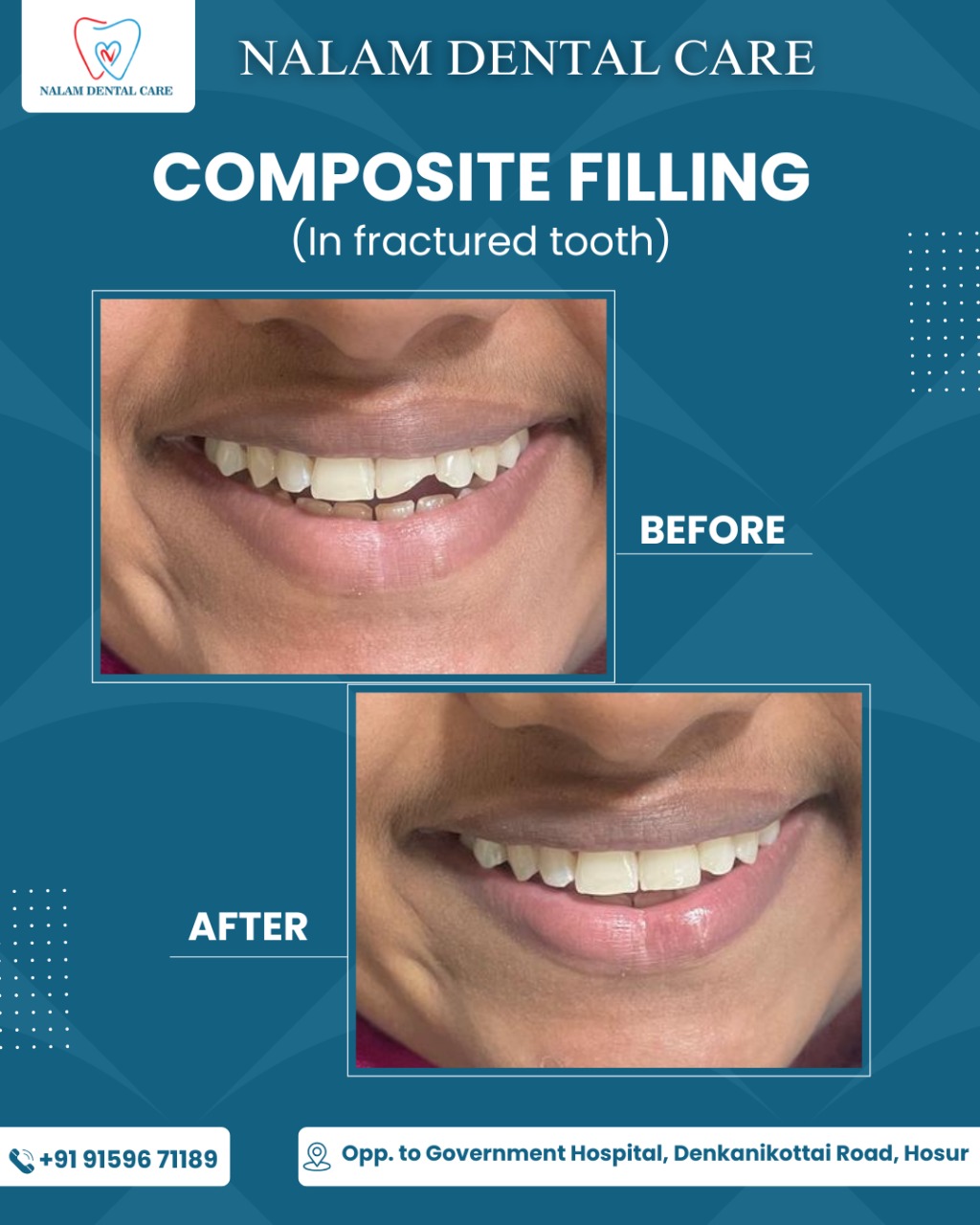 best dental hospial hosur