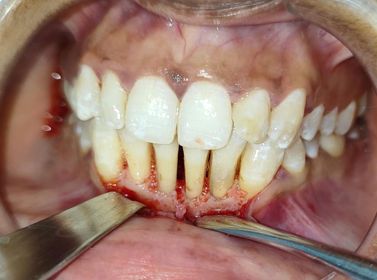 best dental hospial hosur